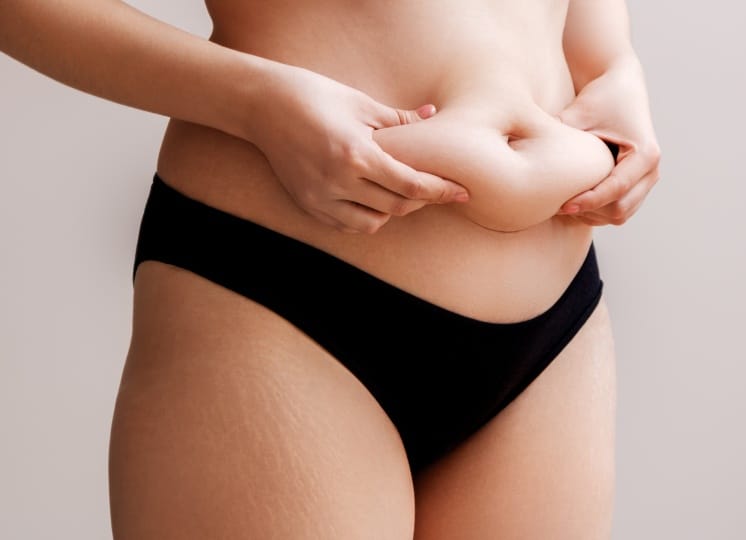 Comment savoir si on a besoin d'une abdominoplastie ? | Dr Prévot | Genève