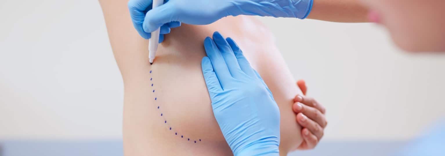 Réduction mammaire sans cicatrices